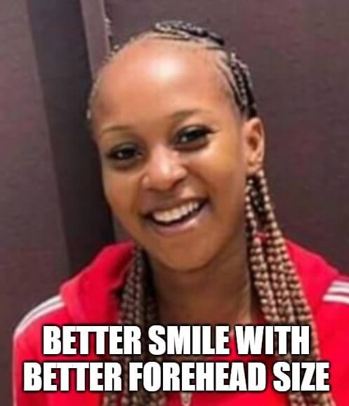smile big forehead meme